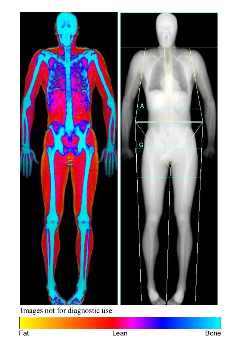 Bodyfat DEXA scan results.