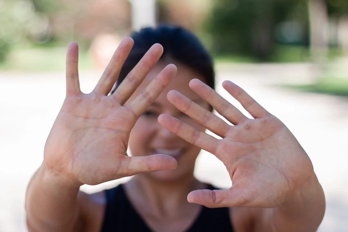 Kim showing her calluses in front of her face